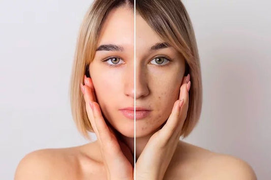 A GUIDE TO NON-COMEDOGENIC BEAUTY PRODUCTS - IORA India